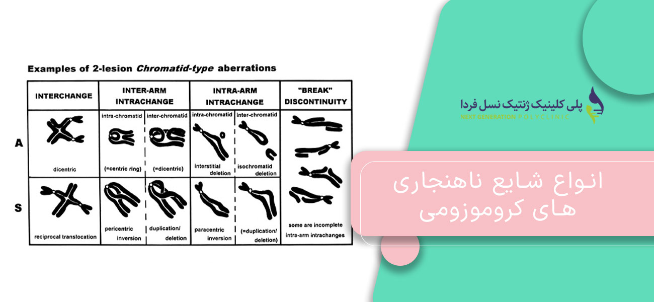 انواع شایع ناهنجاری های کروموزومی