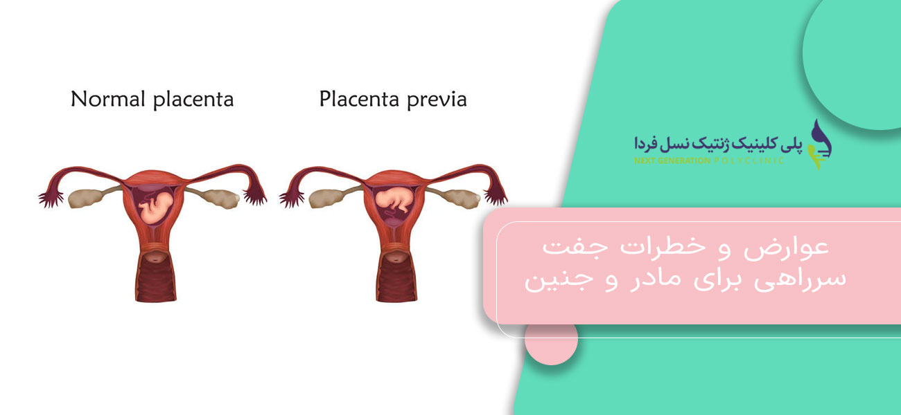 Maternal and Fetal Risks Associated with Placenta Previa