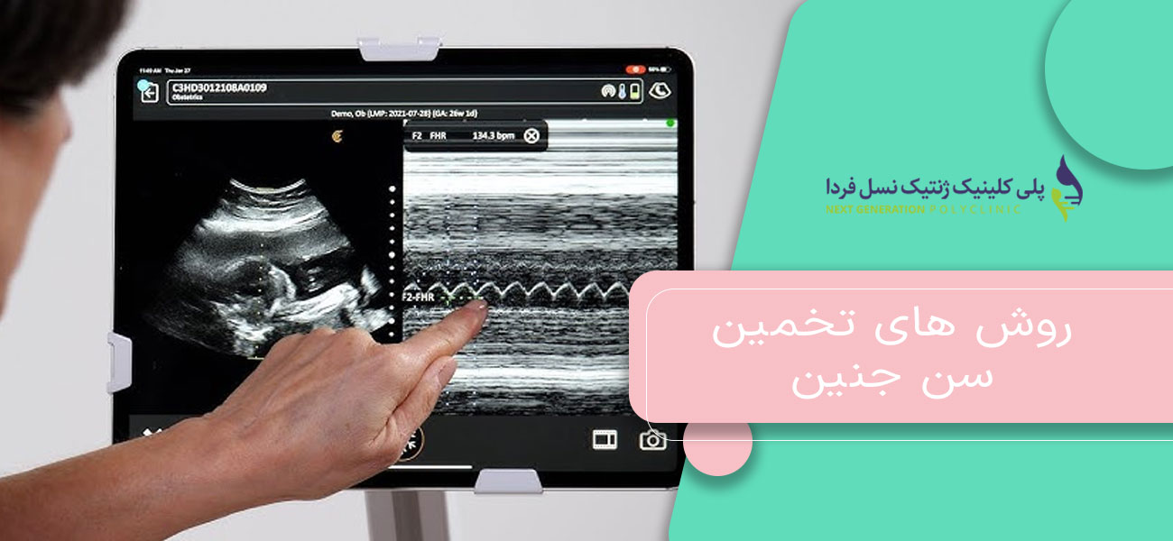 روش های تخمین سن جنین