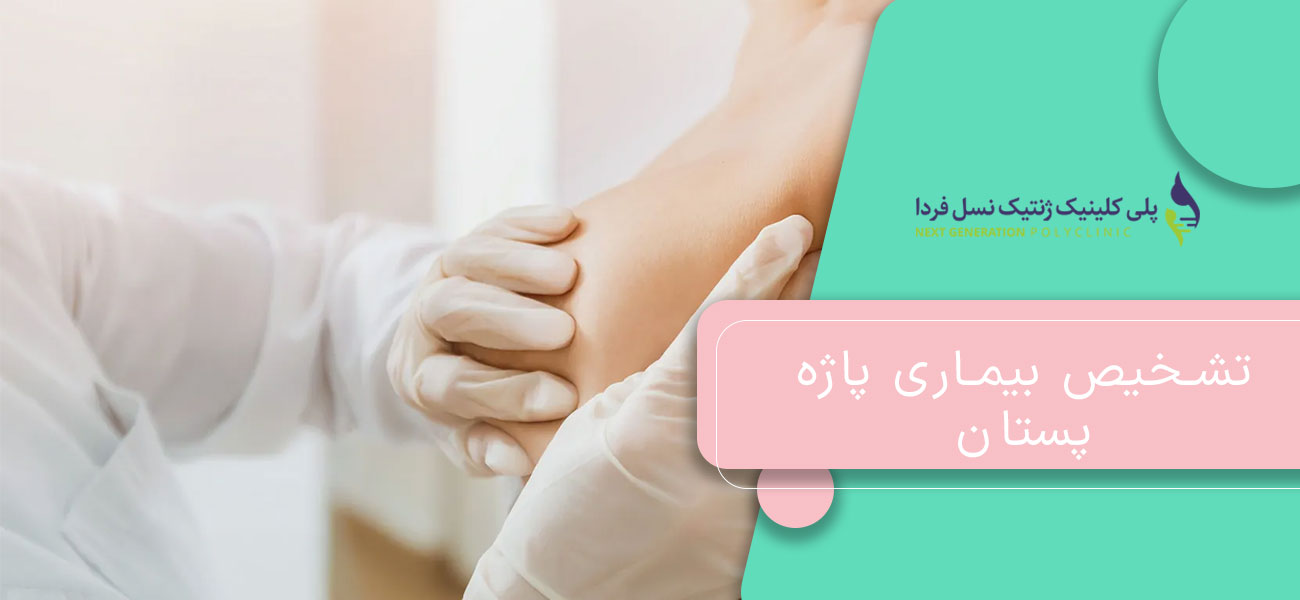 تشخیص بیماری پاژه پستان
