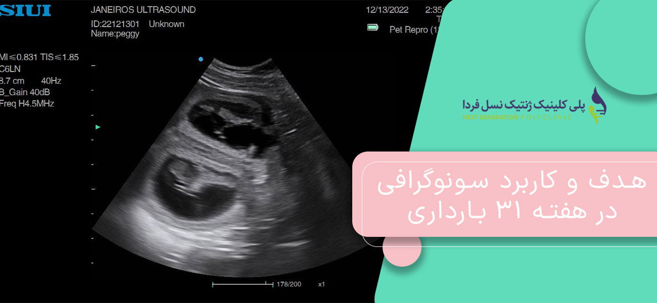 هدف و کاربرد سونوگرافی در هفته ۳۱ بارداری
