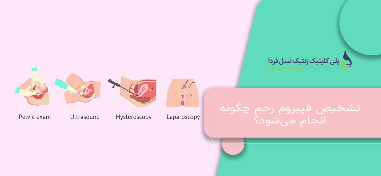 تشخیص فیبروم رحم چگونه انجام میشود