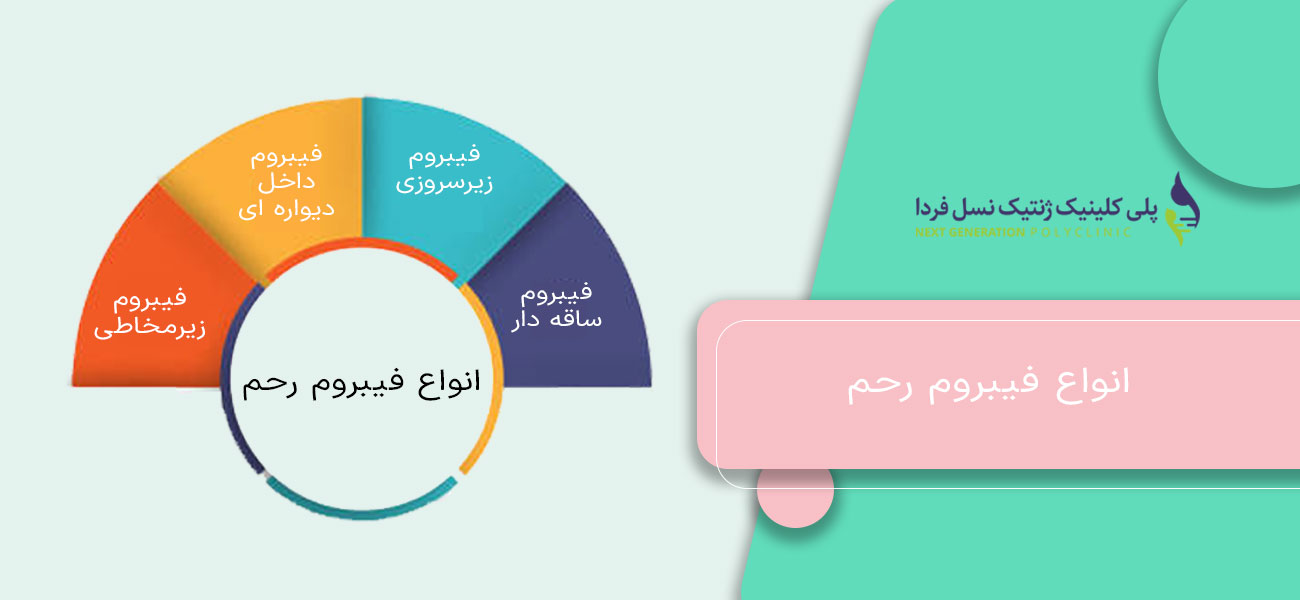 انواع فیبروم رحم