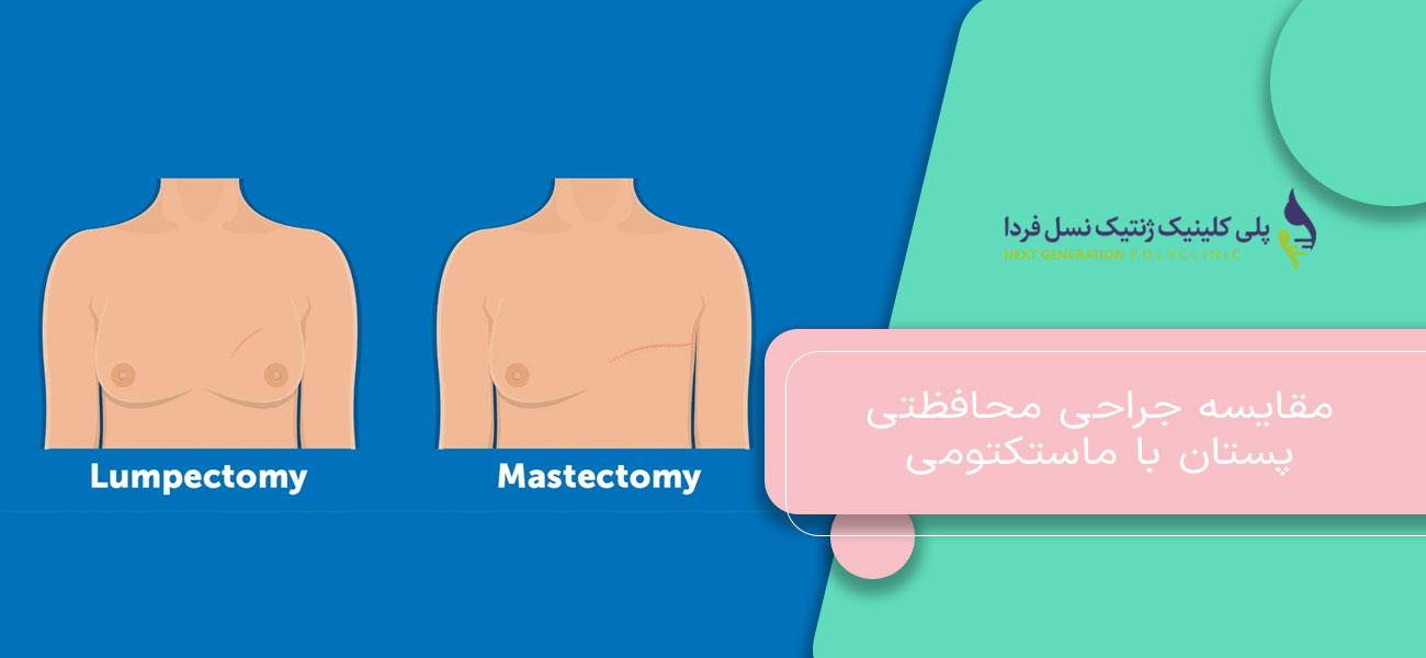 مقایسه جراحی محافظتی پستان با ماستکتومی