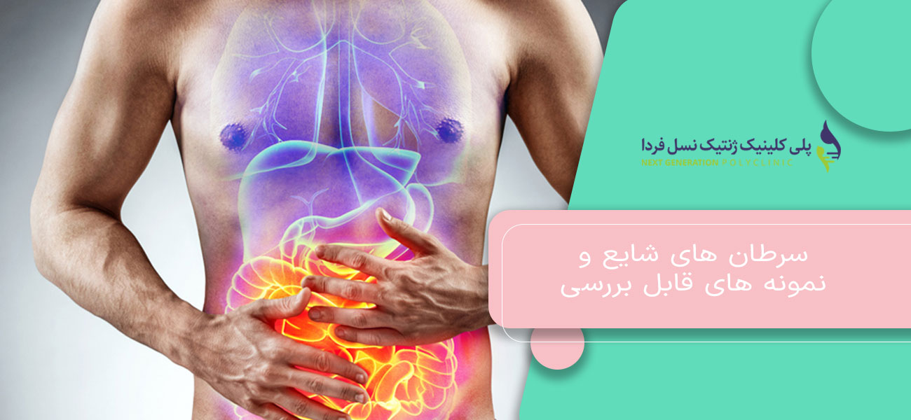 سرطان های شایع و نمونه های قابل بررسی