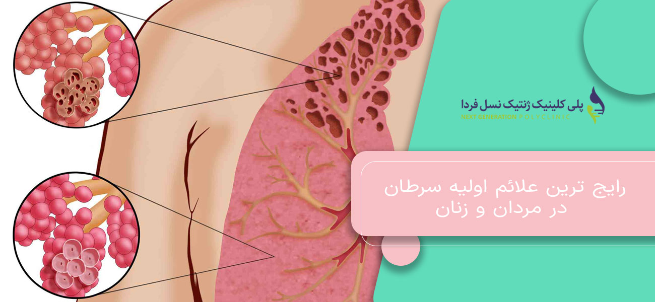 رایج ترین علائم اولیه سرطان در مردان و زنان