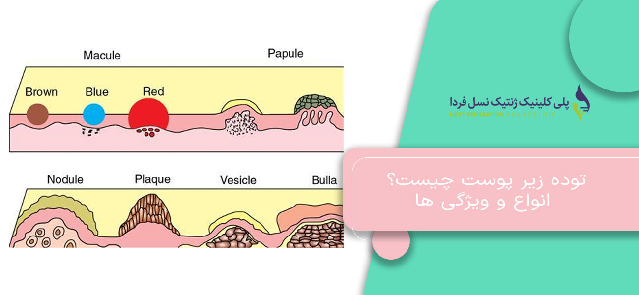 توده زیر پوست چیست؟ انواع و ویژگی ها