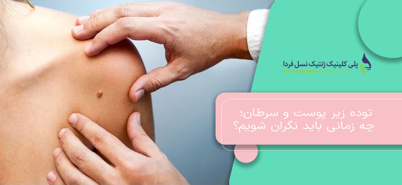 توده زیر پوست و سرطان؛ چه زمانی باید نگران شویم؟