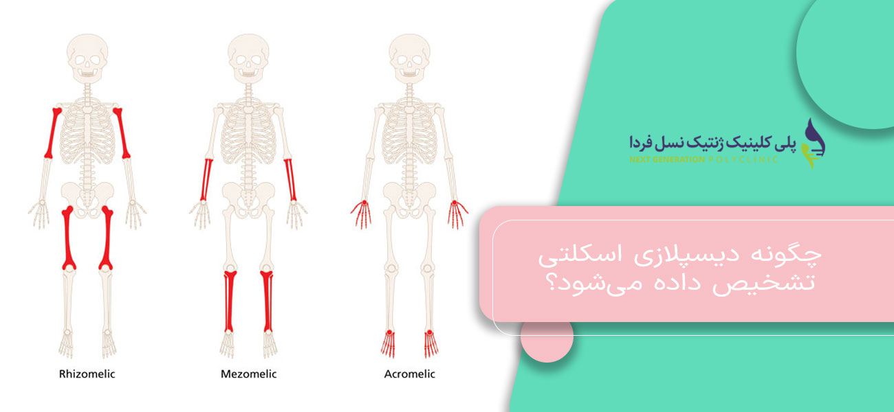 چگونه دیسپلازی اسکلتی تشخیص داده میشود؟