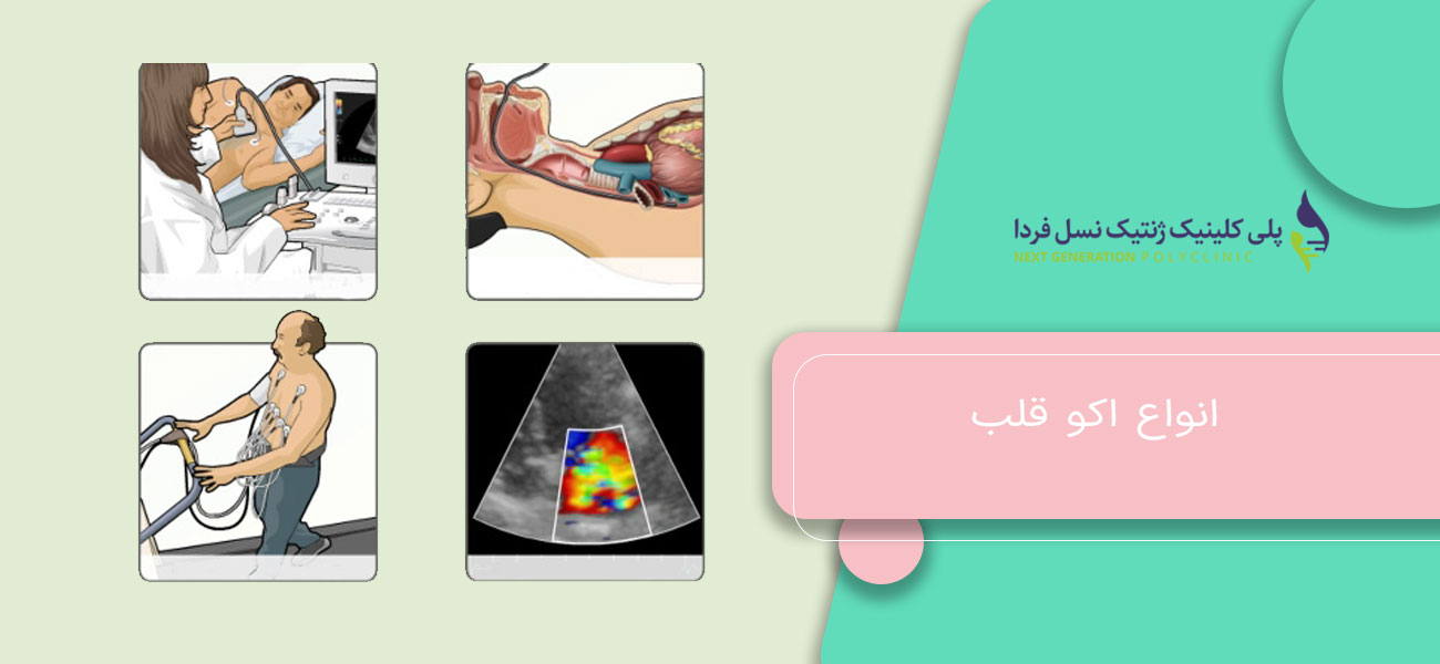 انواع اکو قلب