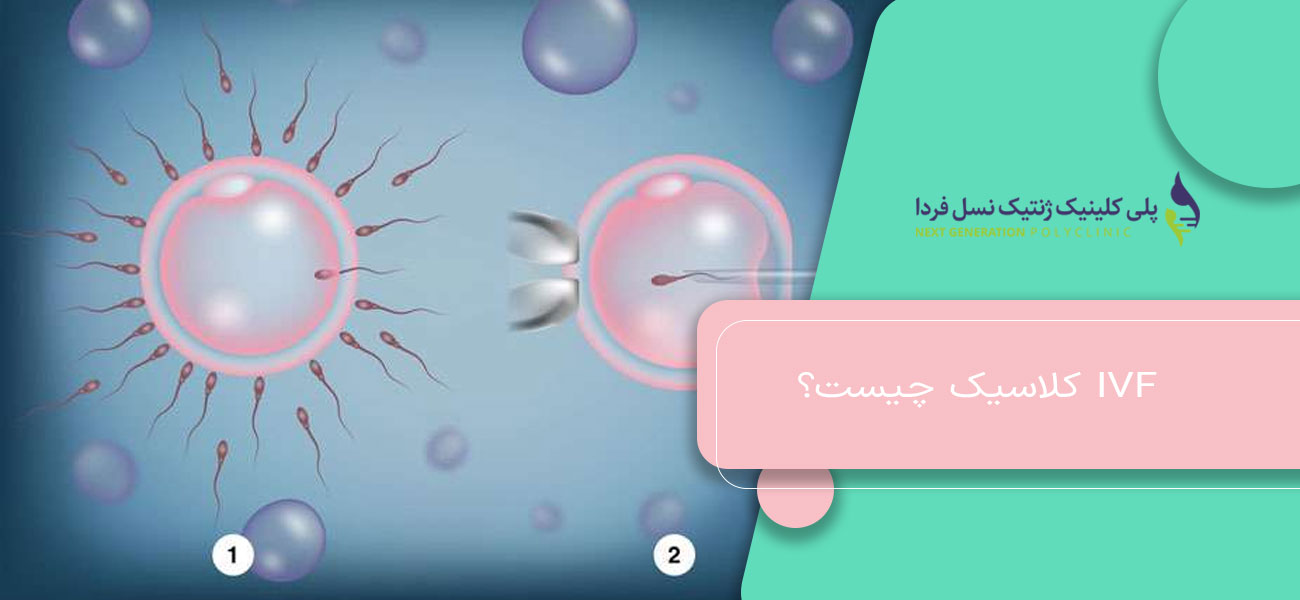 IVF کلاسیک چیست؟
