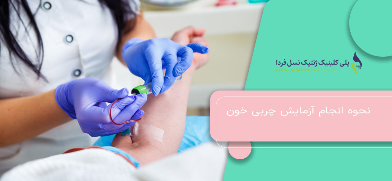 نحوه انجام آزمایش چربی خون