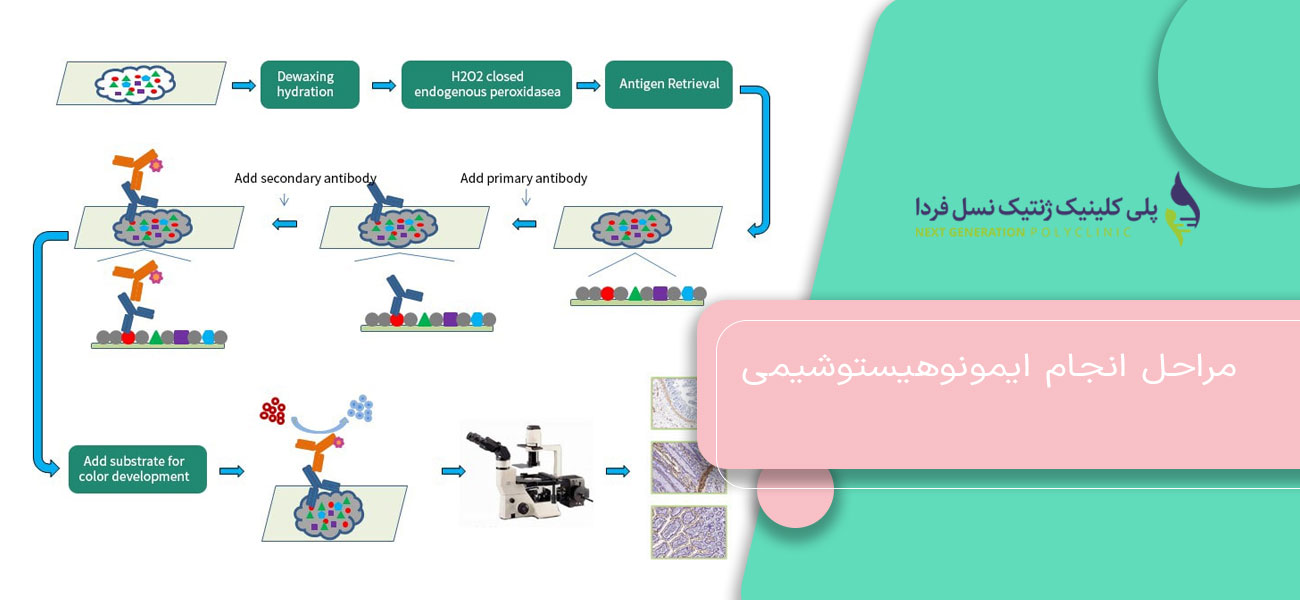 مراحل انجام ایمونوهیستوشیمی