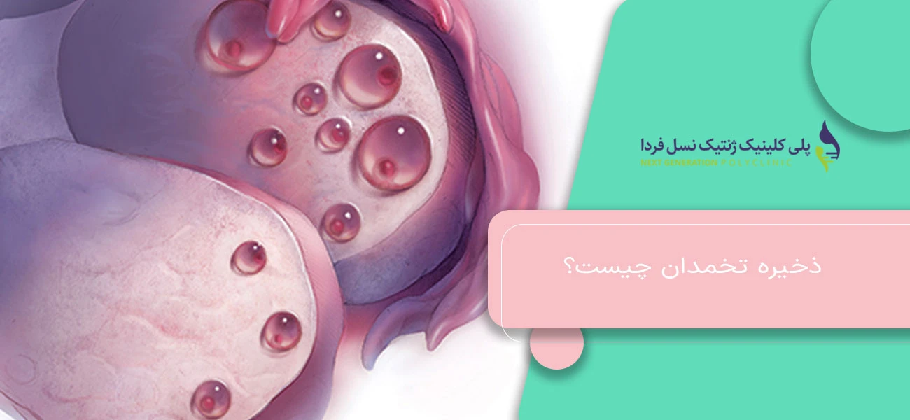 ذخیره تخمدان چیست؟