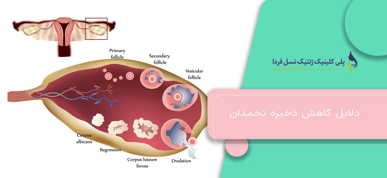 دلایل کاهش ذخیره تخمدان