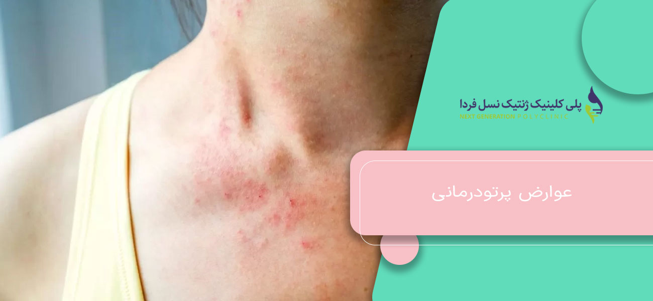عوارض پرتودرمانی