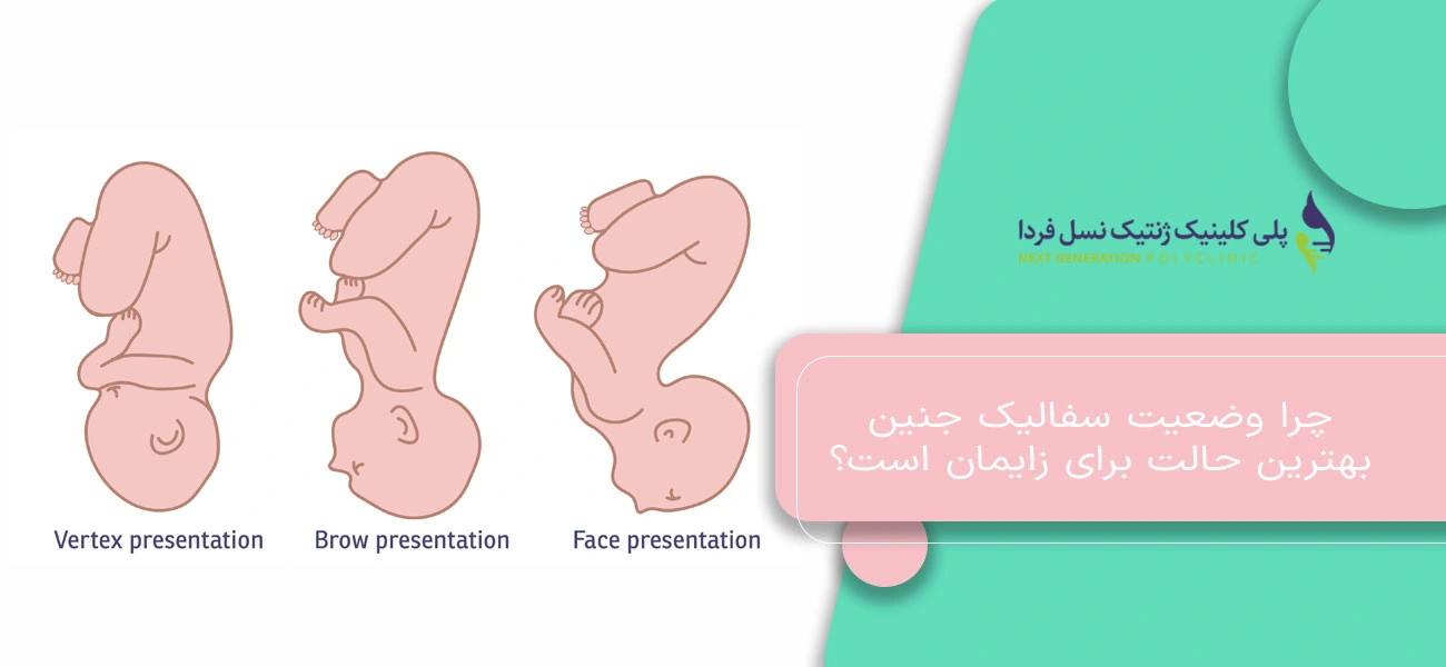 چرا وضعیت سفالیک جنین بهترین حالت برای زایمان است؟