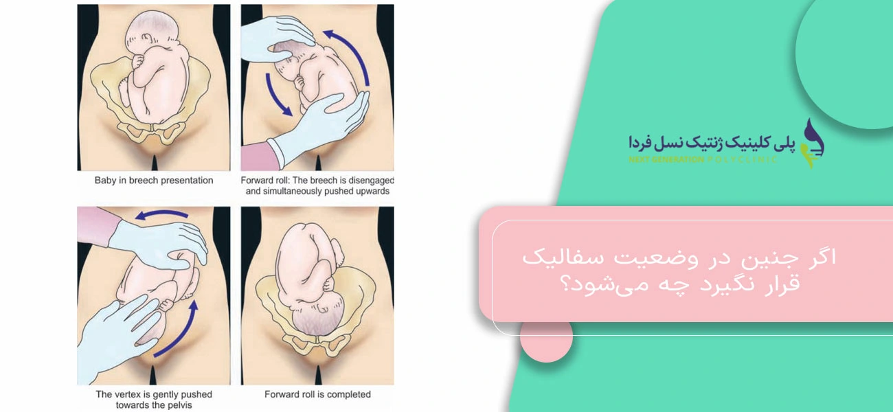 اگر جنین در وضعیت سفالیک قرار نگیرد چه میشود؟