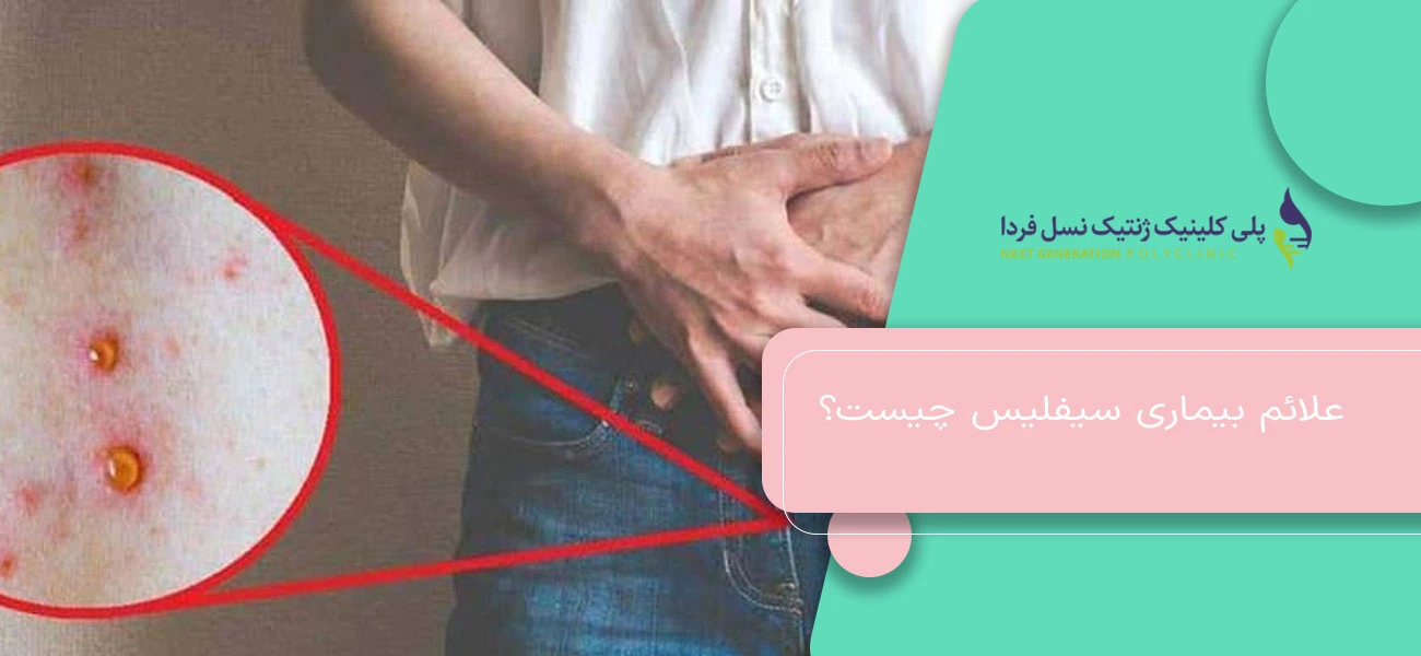 علائم بیماری سیفلیس چیست؟
