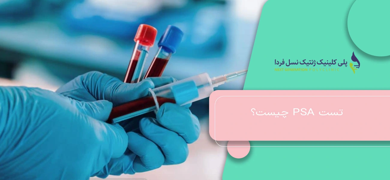 تست PSA چیست؟