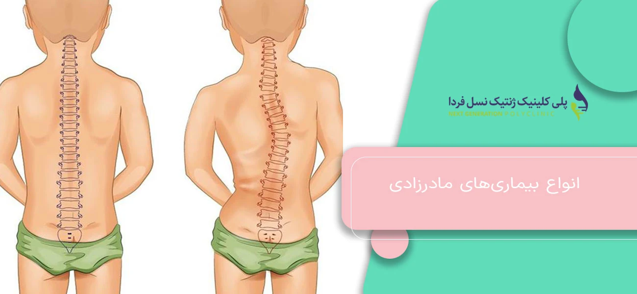 انواع بیماریهای مادرزادی