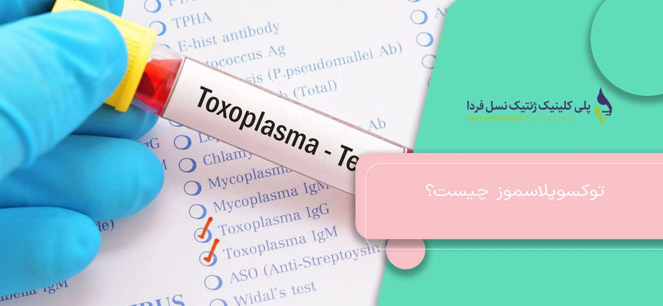 توکسوپلاسموز چیست