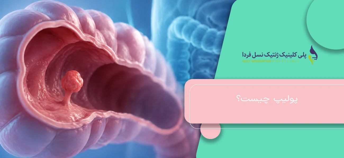 پولیپ چیست؟