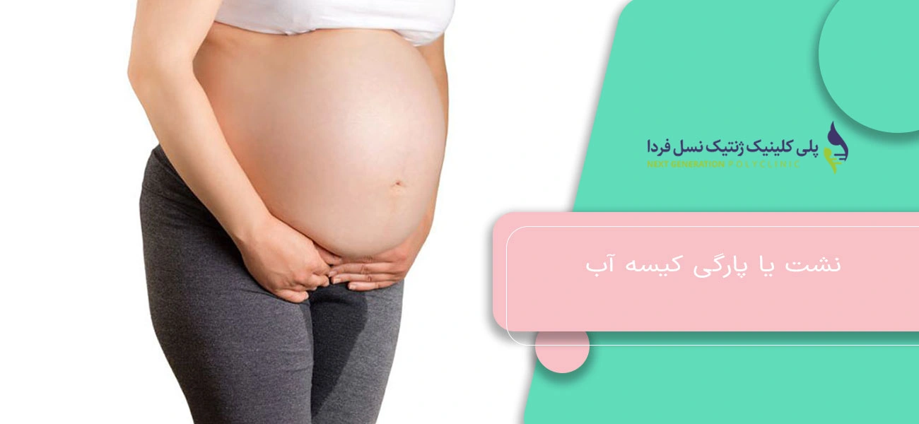نشت یا پارگی کیسه آب