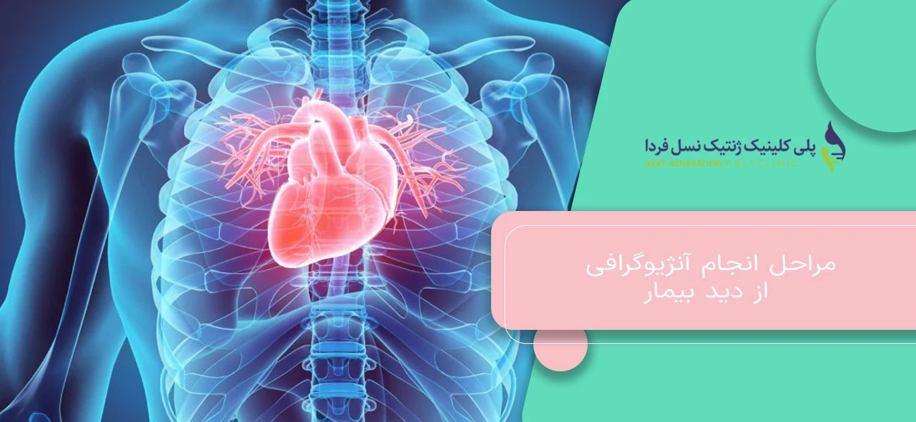 مراحل انجام آنژیوگرافی از دید بیمار
