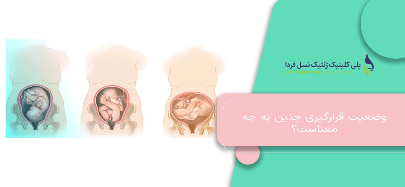 وضعیت قرارگیری جنین به چه معناست؟
