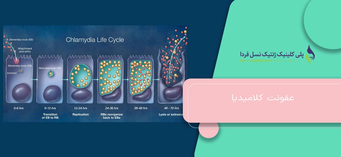 عفونت کلامیدیا