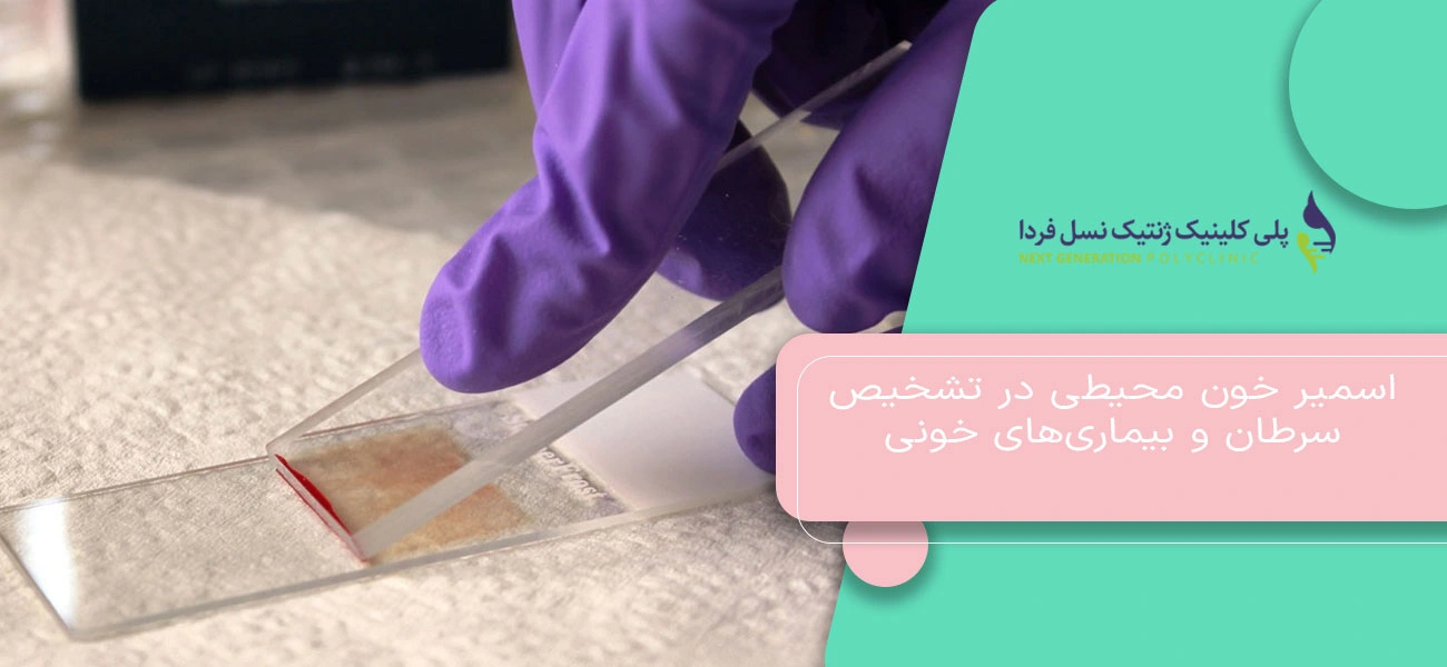 اسمیر خون محیطی در تشخیص سرطان و بیماریهای خونی