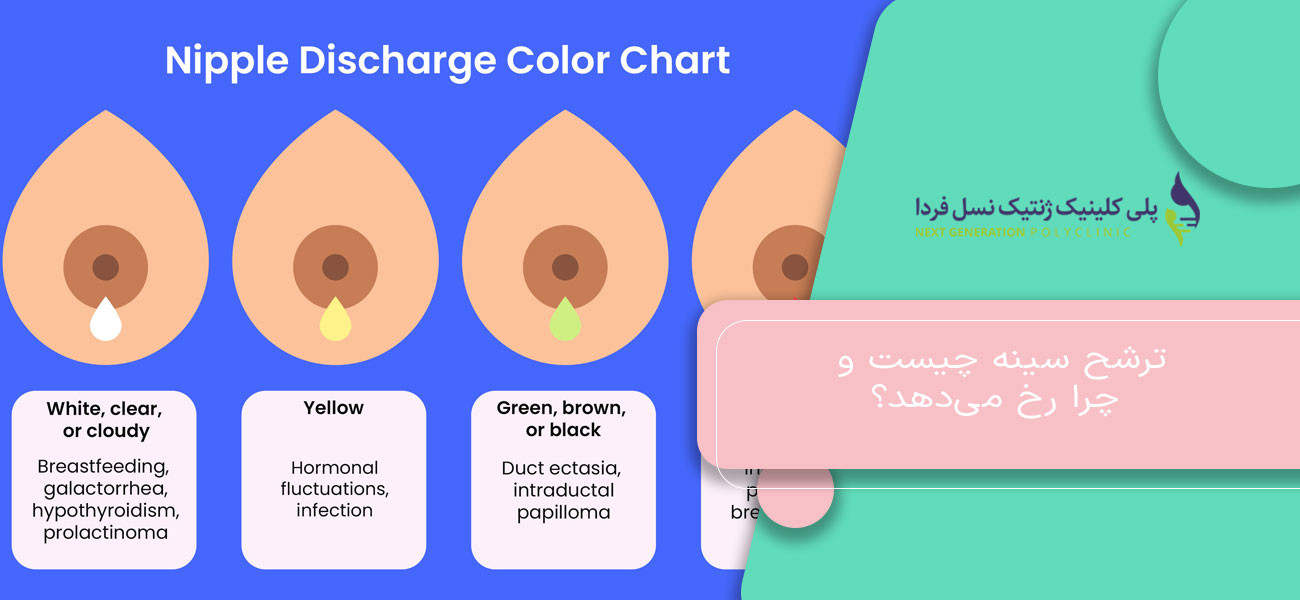 ترشح سینه چیست و چرا رخ میدهد؟