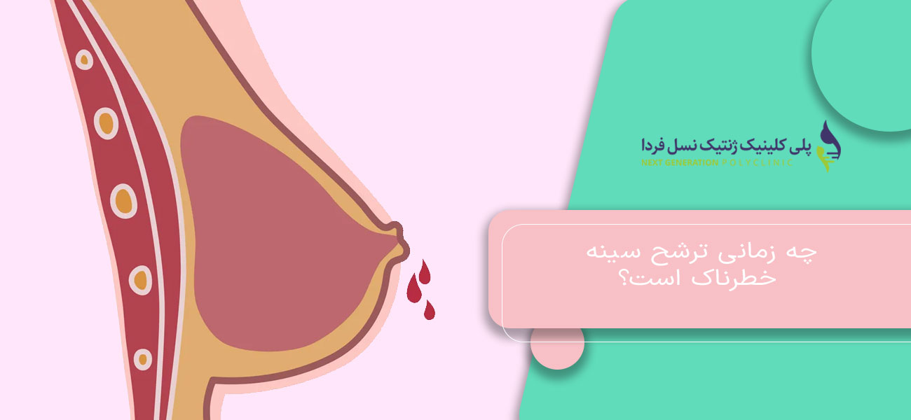 چه زمانی ترشح سینه خطرناک است؟