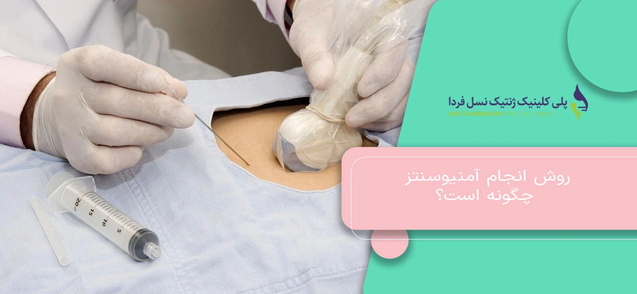 روش انجام آمنیوسنتز چگونه است؟
