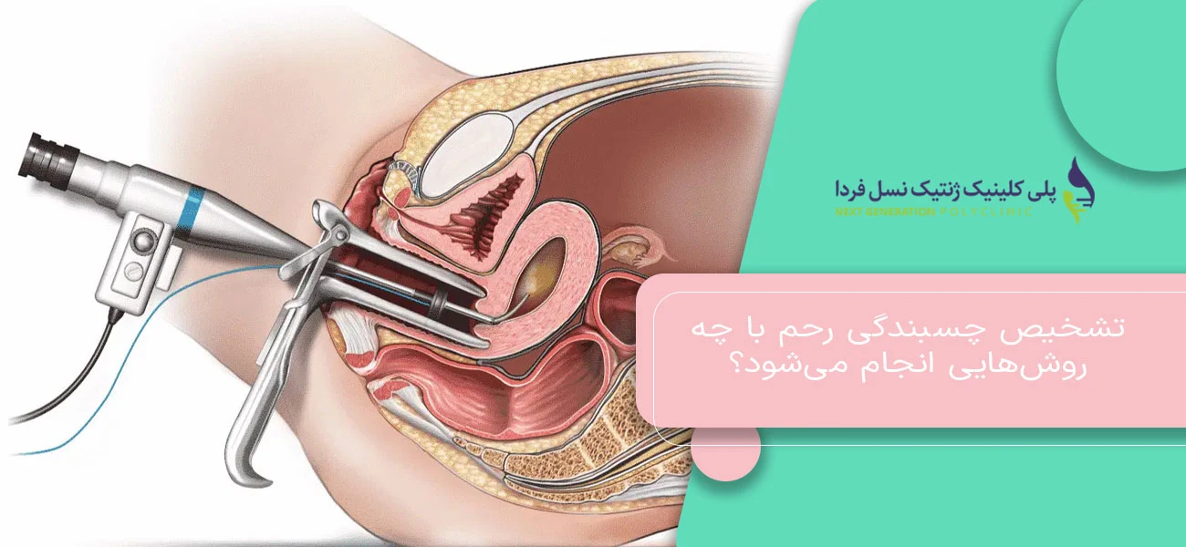 تشخیص چسبندگی رحم با چه روشهایی انجام میشود؟