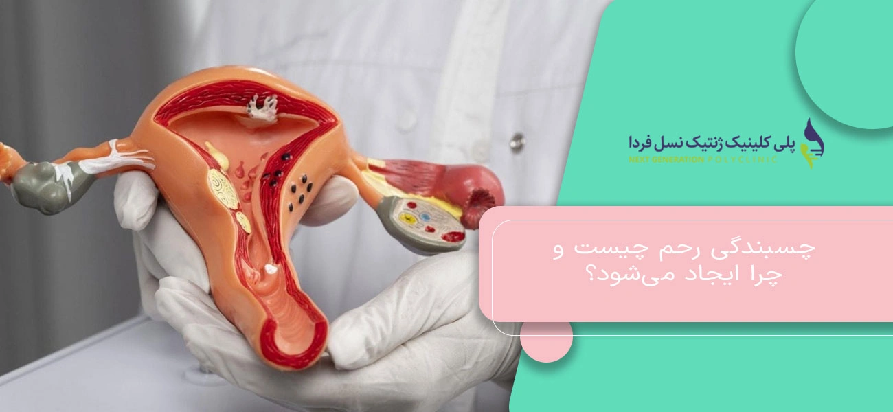 چسبندگی رحم چیست و چرا ایجاد میشود؟