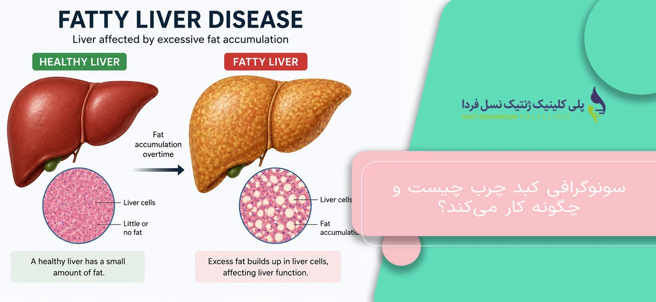 سونوگرافی کبد چرب چیست و چگونه کار میکند؟